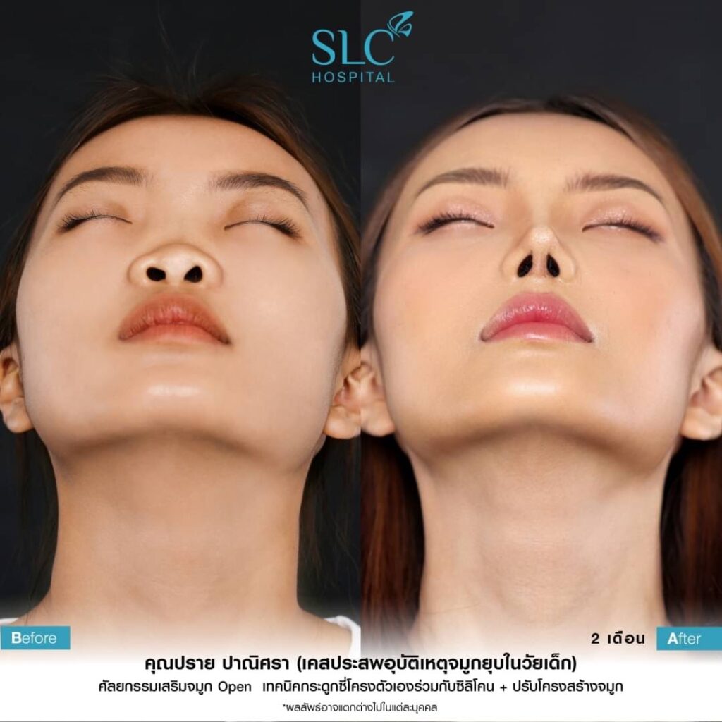 SLC Hospital
