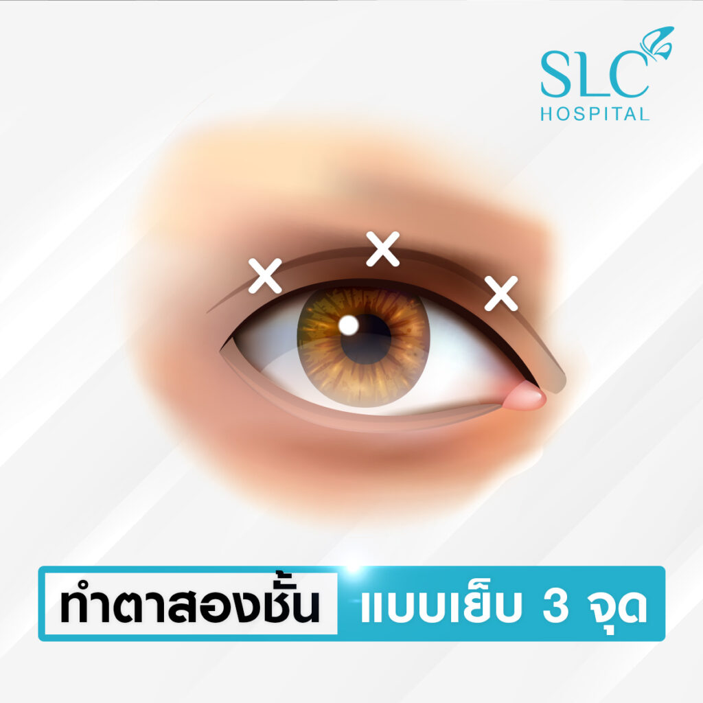 SLC Hospital