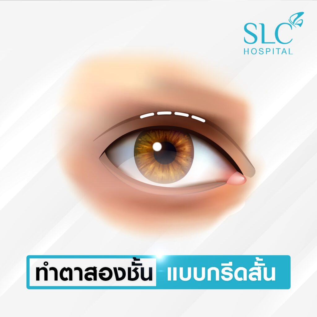 SLC Hospital