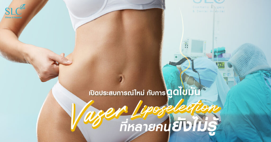 vaser liposelection