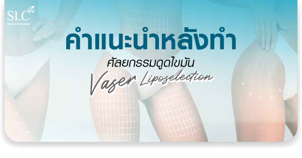 ดูดไขมัน Vaser LipoSelection