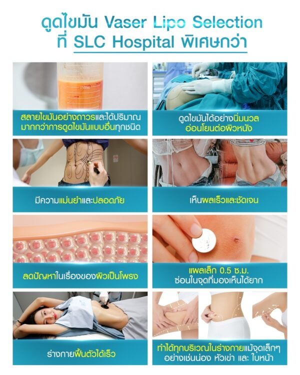 ดูดไขมัน Vaser LipoSelection