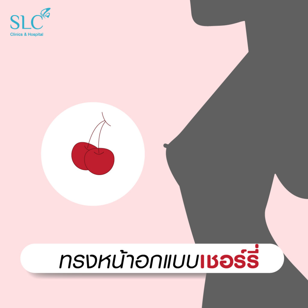 ทรงหน้าอกแบบเชอร์รี