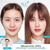 รีวิวทรงจมูกผู้หญิง