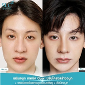 รีวิวทรงจมูกผู้ชาย