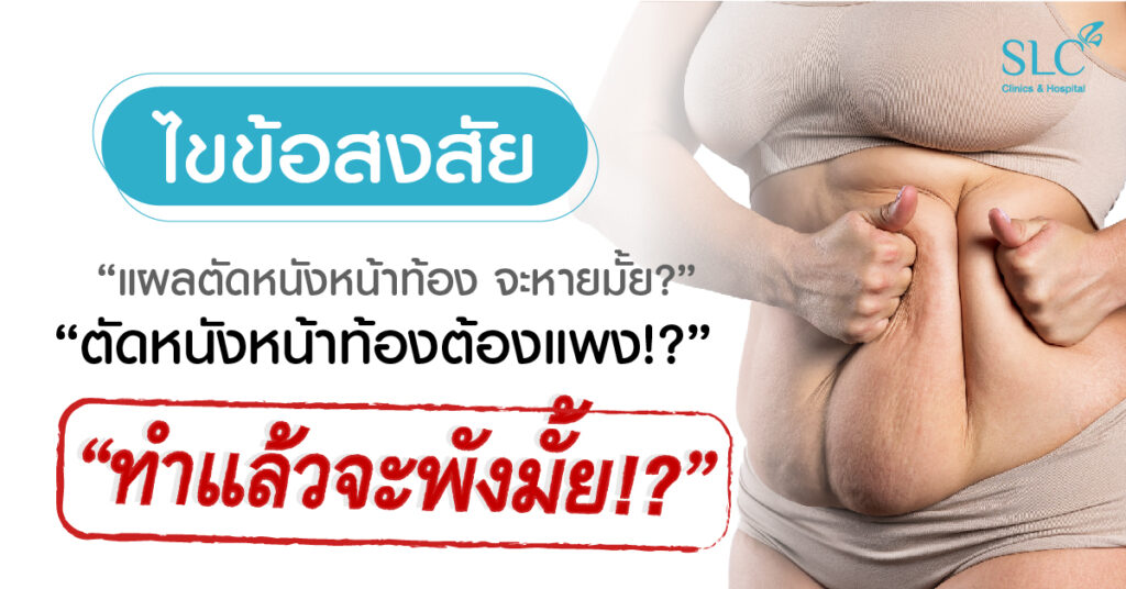 ไขข้อสงสัยที่ว่า “แผลตัดหนังหน้าท้องจะหายมั้ย