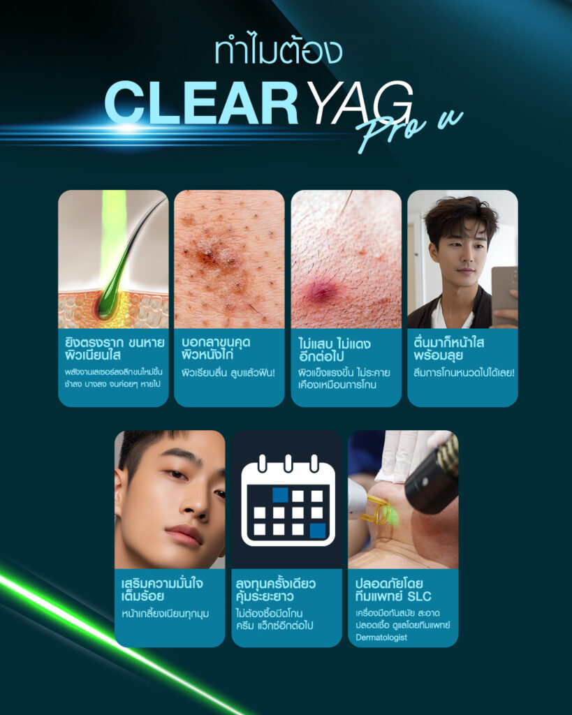 why-clear-yag-pro-u-beard-laser-removal