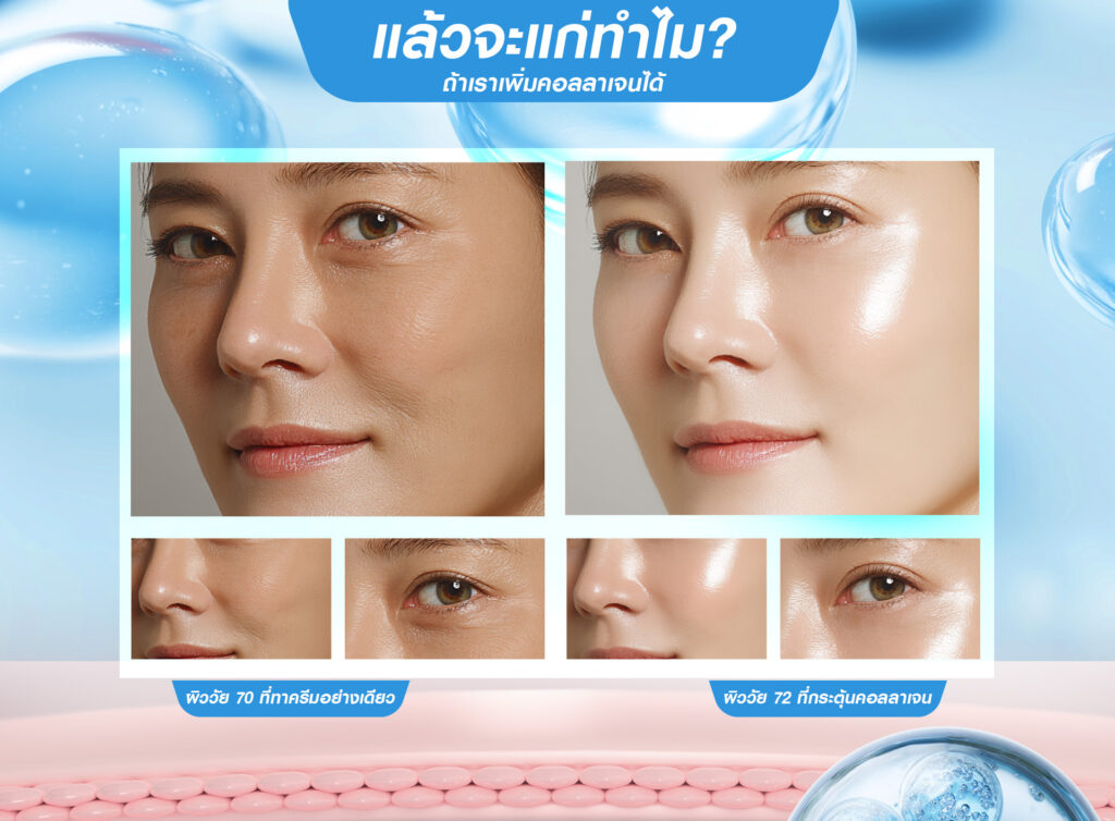 Biostimulator, สารกระตุ้นคอลลาเจน, คอลลาเจน, ผิวชุ่มชื้น, เกราะป้องกันผิว, หน้าเด็ก, หน้าแก่ก่อนวัย
