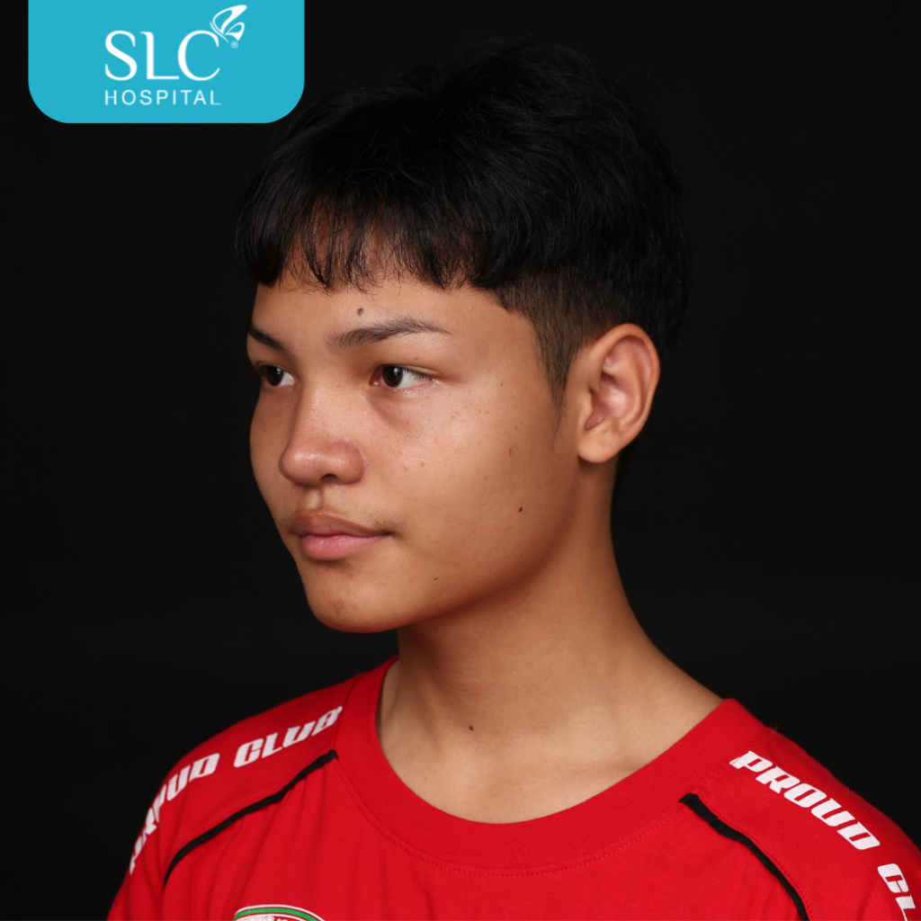 เสริมจมูก Semi Open หมอจี, SLC Hospital, เสริมจมูก Semi Open ดีไหม, เสริมจมูก Semi Open ที่ไหนดี