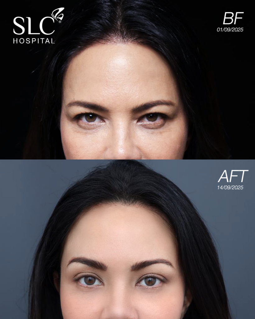 พิม ซอนย่า, SLC Hospital, พิม ซอนย่า, โปรแกรม Sonia Secret Body Contouring, โปรแกรม SLC Holiday Lift™