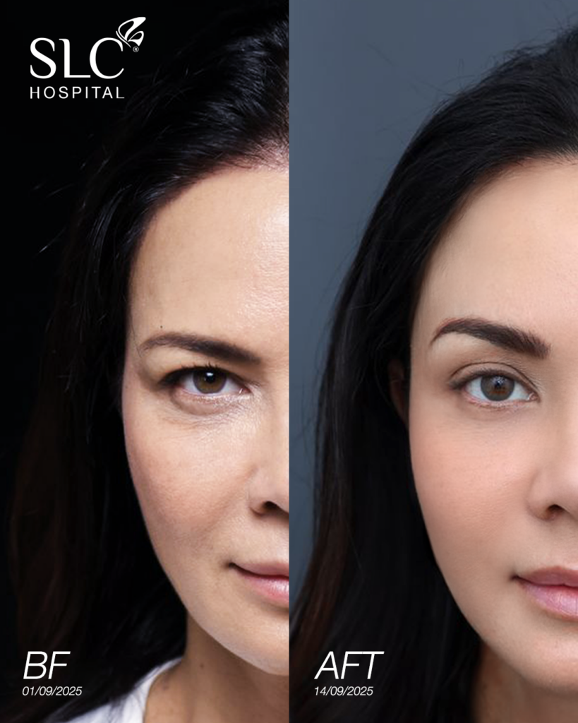 พิม ซอนย่า, SLC Hospital, พิม ซอนย่า, โปรแกรม Sonia Secret Body Contouring, โปรแกรม SLC Holiday Lift™